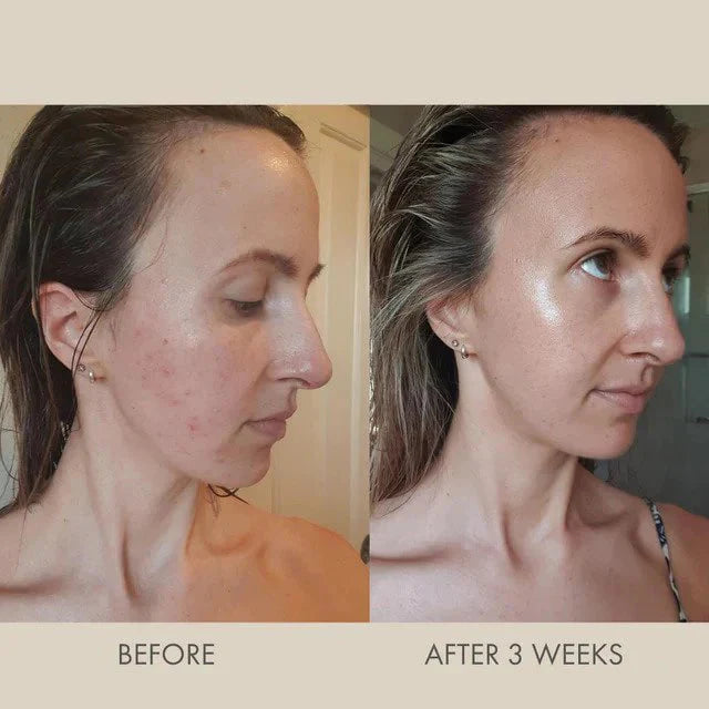 LuminoRegen™ - The Youth Glow Restorer